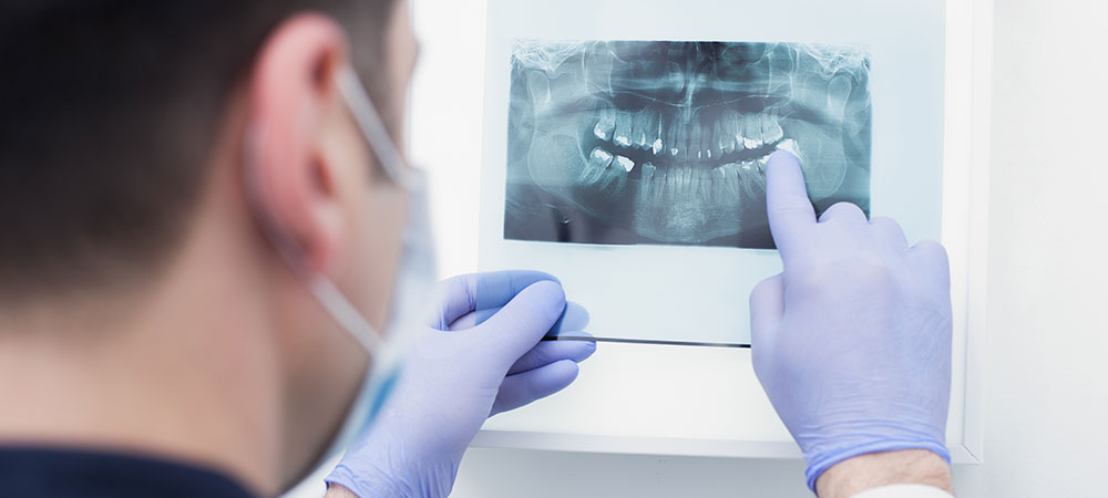 Cirurgia-Bucal-e-Maxilo-Facial