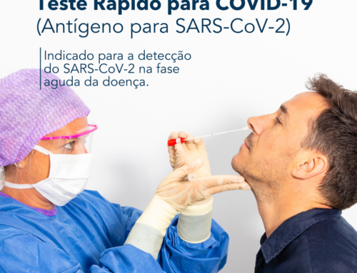 Teste Rápido para COVID-19 – Antígeno para SARS-CoV-2